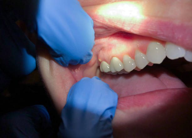 Best Emergency Dental Surgery in Kingston, NY