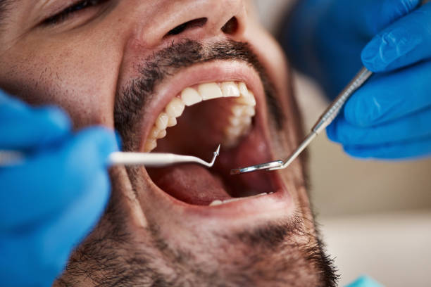 Best Emergency Treatment for Toothache in Kingston, NY